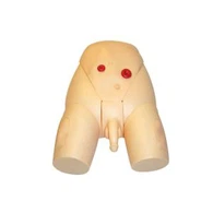 Liječenje kateterizacije uretre